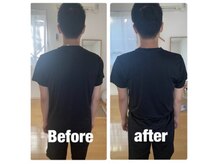 トトノウ 自由が丘店(totonou)/Before after (18)