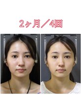 顔と身体の歪み矯正院 吉祥寺/ビフォーアフター