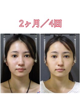 顔と身体の歪み矯正院 吉祥寺/ビフォーアフター