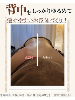 イストアールエム(HISTOIRE.M)/筋膜リリースメンテナンス