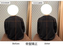 ヘッドスパ/美容鍼灸/整体/伏見/大手筋