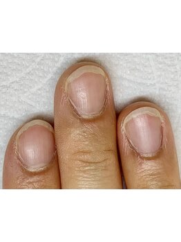 爪の悩みを解消できる（ケア含む）