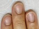 ネイルルーム エンヌ(nail room en'ne)の写真/爪が薄い/深爪/二枚爪/平爪etc.爪を綺麗にしたい方に◎画像は1枚目のビフォーになります！