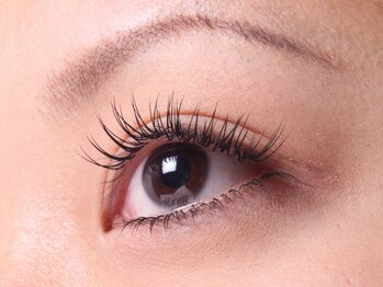 ヴィヴァーチェ 新宿店(Vivace)/施術後【３】