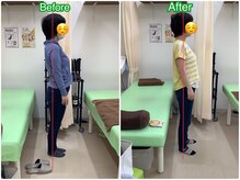ぜんた整骨院/産後骨盤矯正