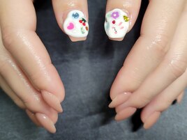 埋め込みネイル