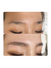 イスピリス(ESPERIS)/ブロウマッピング