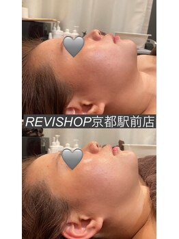 ルヴィショップ 京都駅前店(REVI SHOP)/