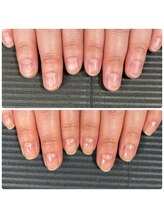 ウェルズユキ(well's yuki)/むしり癖