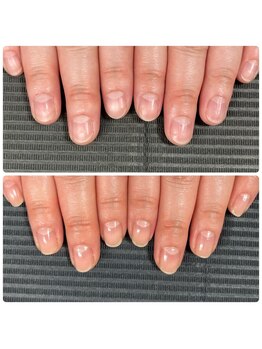 ウェルズユキ(well's yuki)/むしり癖