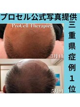 スリール(sourire)/三重県プロセル改善症例数No1