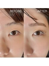 イヨヨ(iyoyo)/LEDフラット+下まつげパーマ+眉