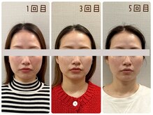 ナツメ鍼灸院(natume鍼灸院)の雰囲気(骨格から整える大人小顔矯正)