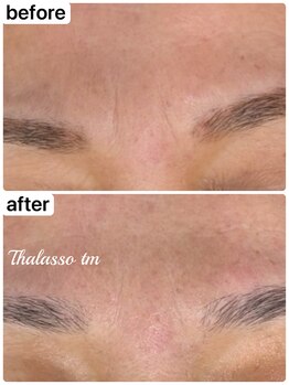 アール(R)/【タラソトリートメント】