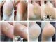 ネイルエイト 新百合ヶ丘(nail8)の写真/【ドイツ式】最短20分～足裏全体の集中コースまで！夏が来る前に最新マシンでガサガサかかとを徹底リセット