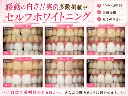メルヴェイユの写真