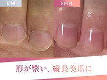 つきしずくの雰囲気（常に視界に入る手元をより綺麗に、印象が変わります♪）