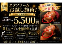 アンテグラール