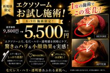 アンテグラール