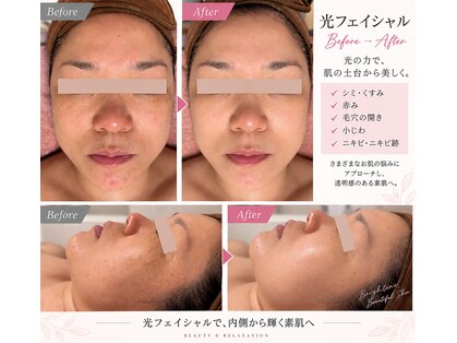 カモミール(Camomille)の写真