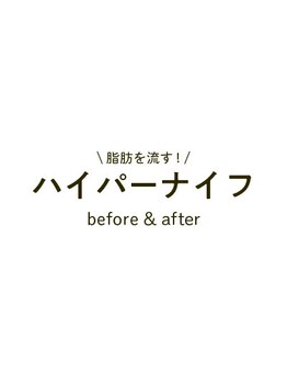 ソルニス(Solnis.)/ハイパーナイフ before&after