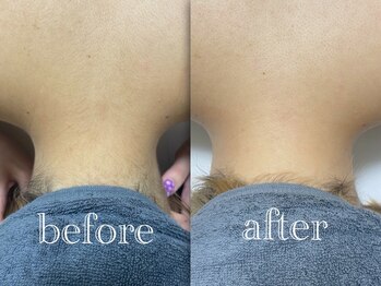 マドンナリリー 恵比寿店(Madonna Lily)/うなじ