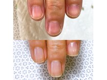ジェルで自爪育成。ケアで育成。選べる育成法で爪の形を美爪に。