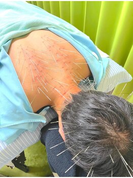 ナゴミ(和 nagomi)の写真/【鍼灸院っぽくない鍼灸院！】完全個室カフェのような落ち着く空間でゆったり施術★新潟唯一のルート鍼！