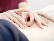 やお駅前鍼灸接骨院/鍼灸施術