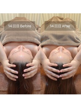 スリージー/before/after