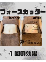 めいてる/ダイエット/ぽっこりお腹/大阪市