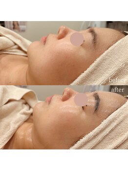 ベルチェリカ(Belle CHERIKA)/クリスティーナ・アンストレス