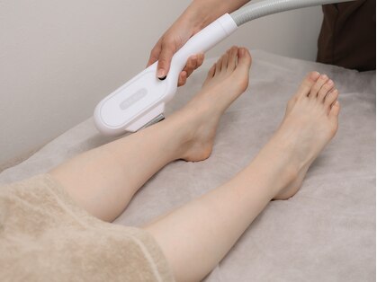 ラエッセ(LAESSE)の写真