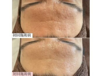 ラエッセ 目黒 白金台店(LAESSE)/毛穴・美白専門店 LAESSE 白金台