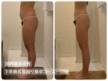 ピーエフ トウキョウ(PF TOKYO)/ハイパーナイフEX/下半身痩身