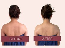 アンリール(Anrire)/【板橋/フェイシャルエステ】