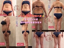 ビヴィアス(BIVIAS)