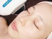 美肌脱毛サロンラー 長岡店(Ra)