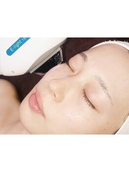 お肌をきれいにしたい