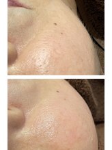 美麗(MIREI)/スキンケアWAXのBefore→After
