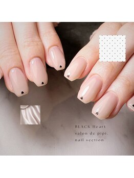 #岡崎#パラジェル#フィルイン