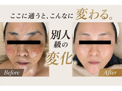 スリミア(Slimia)の写真