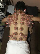 フットスタイル 八丁堀店(FOOT STYLE)/吸い玉