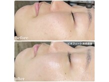 ちらちゅら/クリスティーナ【ビオフィート】