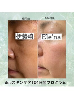 エレナ 伊勢崎(Ele'na)/DOCスキンケアで肌悩みを解決!