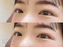 アペル(APPEL)/ラッシュリフト