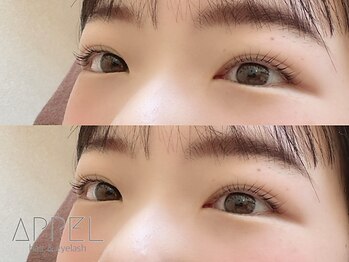 アペル(APPEL)/ラッシュリフト