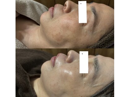 エステドルース(esthe de Ruth.)の写真