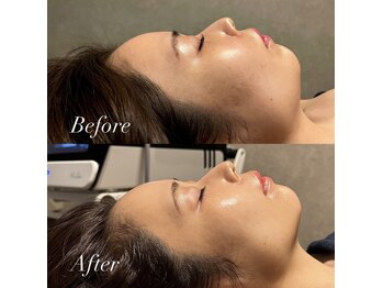 ラリリー(La Lily)