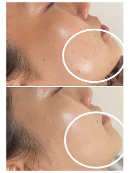 グリンプラス(grin+)/西京区/桂駅/フェイシャル